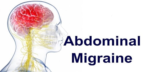 Abdominal Migraine