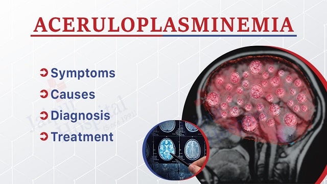 Aceruloplasminemia