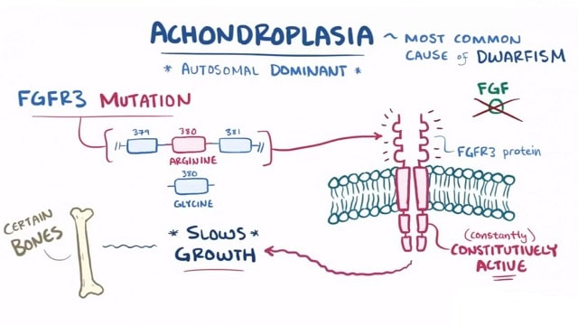 Achondroplasia