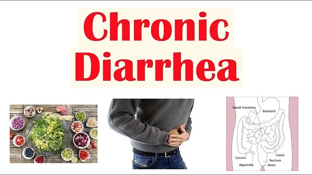 Chronic Diarrhea