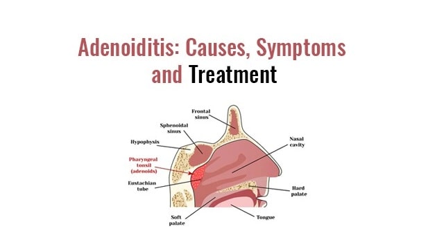 Adenoiditis