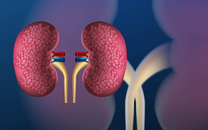 Kidney Disease