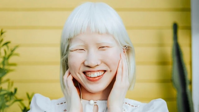 Why Genetic Mutations Can Cause Albinism