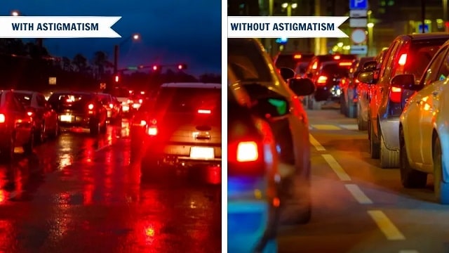 Astigmatism