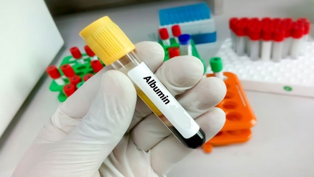 Albumin Check