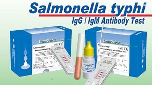 Anti-Salmonella Immunoglobulin M Test