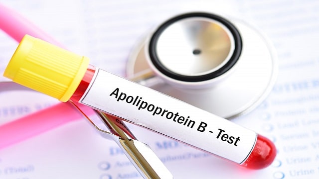 Apolipoprotein B (Apo B) Test