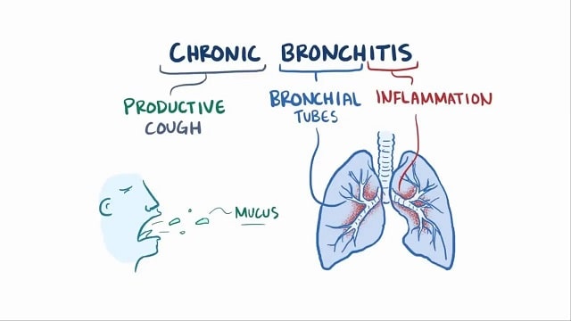 Bronchitis