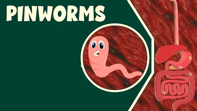 Pinworms