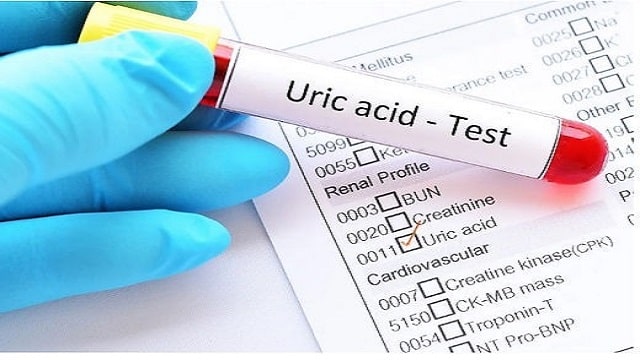 Uric Acid Check