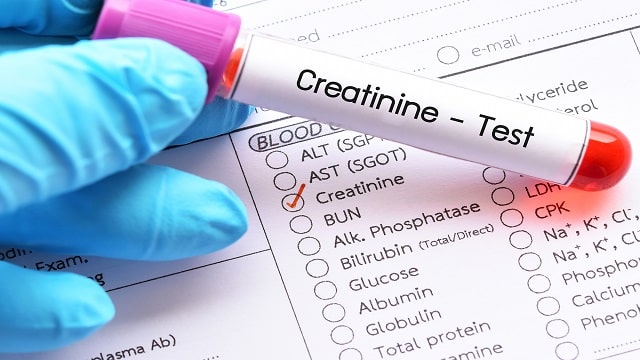 Creatinine Check