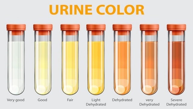 Urine Check