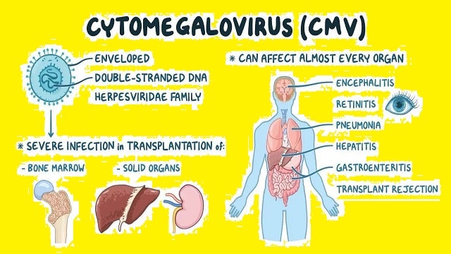 Cytomegalovirus